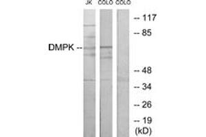 Western blot analysis of extracts from Jurkat/COLO205 cells, using DMPK Antibody. (DMPK Antikörper  (AA 11-60))