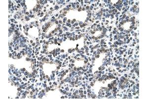 KCTD6 antibody was used for immunohistochemistry at a concentration of 16.
