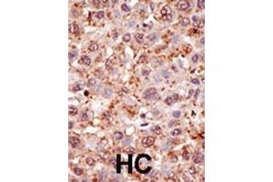 Immunohistochemistry (Paraffin-embedded Sections) (IHC (p)) image for anti-Protein Inhibitor of Activated STAT, 2 (PIAS2) (AA 109-140), (N-Term) antibody (ABIN6242527)