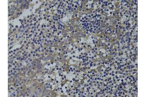 Immunohistochemistry of paraffin-embedded human tonsil using GNA15 antibody (ABIN1872841) at dilution of 1:100 (40x lens).