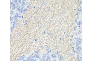 Immunohistochemistry of paraffin-embedded Rat brain using THY1 Polyclonal Antibody at dilution of 1:100 (40x lens). (CD90 Antikörper)