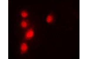 Immunofluorescent analysis of Pontin 52 staining in A549 cells. (RUVBL1 Antikörper)