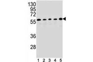 PAX1 antibody western blot analysis in (1) HepG2, (2) MDA-MB453, (3) 293, (4) K562 and (5) MCF-7 lysate. (PAX1 Antikörper  (AA 443-471))