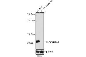 Western blot analysis of extracts from normal (control) and FSP1/S100 knockout (KO) HeLa cells, using FSP1/S100 antibody (ABIN3022287, ABIN3022288, ABIN3022289, ABIN1513494 and ABIN1514638) at 1:1000 dilution. (s100a4 Antikörper  (AA 1-101))