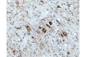 Rat cerebellum, formalin-fixed paraffin embedded tissue, with citrate pre-treatment, 20X. (Gephyrin Antikörper  (AA 569-726))