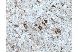 Rat cerebellum, formalin-fixed paraffin embedded tissue, with citrate pre-treatment, 20X. (Gephyrin Antikörper  (AA 569-726))