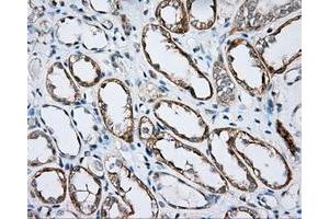 Image no. 5 for anti-Bruton Agammaglobulinemia tyrosine Kinase (BTK) antibody (ABIN1496974) (BTK Antikörper)