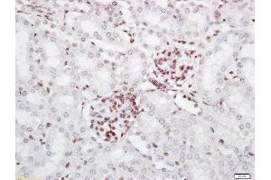 Formalin-fixed and paraffin embedded mouse kidney labeled with Rabbit Anti-PRMT6 Polyclonal Antibody, Unconjugated (ABIN761876) at 1:200 followed by conjugation to the secondary antibody and DAB staining (PRMT6 Antikörper  (AA 301-375))