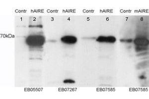 ABIN2560996 staining (0. (AIRE Antikörper  (Internal Region, Isoform 1))