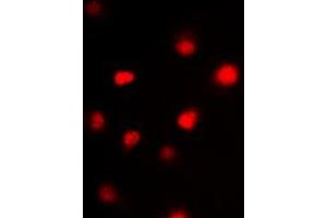 Immunofluorescent analysis of GATA3 staining in HeLa cells. (GATA3 Antikörper  (Center))