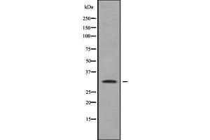 Western blot analysis of RAB40A using Jurkat whole cell lysates