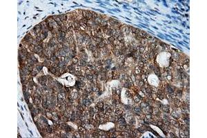 Immunohistochemical staining of paraffin-embedded Kidney tissue using anti-RALBP1 mouse monoclonal antibody. (RALBP1 Antikörper)