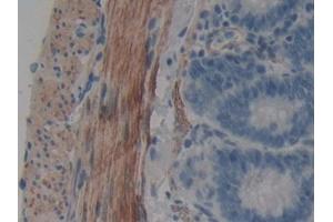 DAB staining on IHC-P; Samples: Rat Intestine Tissue (WIF1 Antikörper  (AA 38-247))