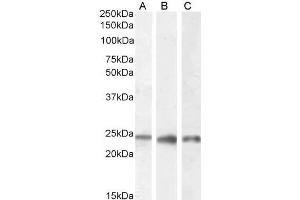 Western Blotting (WB) image for anti-Progesterone Receptor Membrane Component 1 (PGRMC1) (C-Term) antibody (ABIN185610)