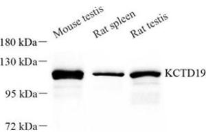 Western blot analysis of KCTD19 (ABIN7075147) at dilution of 1: 50 (KCTD19 Antikörper)
