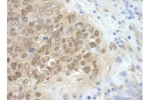 Immunohistochemistry (IHC) image for anti-Cell Division Cycle 6 Homolog (S. Cerevisiae) (CDC6) (AA 1-50) antibody (ABIN7448469) (CDC6 Antikörper  (AA 1-50))