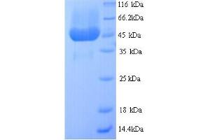 Glyceraldehyde-3-Phosphate Dehydrogenase (G3P) (AA 19-424) protein (His tag)
