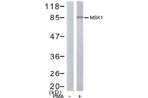 Image no. 1 for anti-Ribosomal Protein S6 Kinase, 90kDa, Polypeptide 5 (RPS6KA5) (Ser376) antibody (ABIN197422) (MSK1 Antikörper  (Ser376))