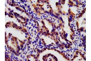 Immunohistochemistry (IHC) image for anti-Lymphotoxin beta Receptor (TNFR Superfamily, Member 3) (LTBR) (AA 31-224) antibody (ABIN7173883)
