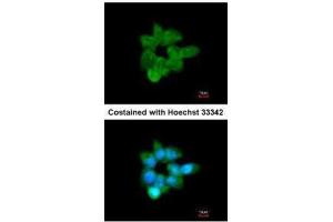 ICC/IF Image Immunofluorescence analysis of methanol-fixed A431, using CLCA1, antibody at 1:200 dilution. (CLCA1 Antikörper)