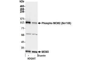 Western Blotting (WB) image for anti-Minichromosome Maintenance Complex Component 2 (MCM2) (pSer108) antibody (ABIN7449366) (MCM2 Antikörper  (pSer108))