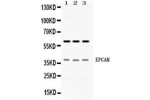 Western blot analysis of EPCAM expression in HELA whole cell lysates ( Lane 1), A549 whole cell lysates ( Lane 2) and PANC-1 whole cell lysates ( Lane 3). (EpCAM Antikörper  (Middle Region))