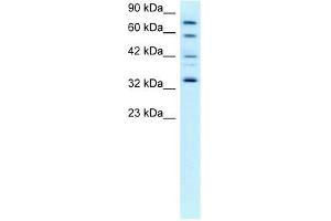 CDK7 antibody (20R-1296) used at 0. (CDK7 Antikörper  (C-Term))