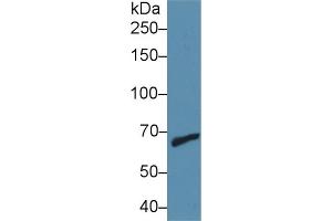 Detection of MMP9 in Human Jurkat cell lysate using Polyclonal Antibody to Matrix Metalloproteinase 9 (MMP9)