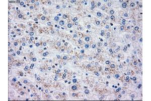 Immunohistochemical staining of paraffin-embedded liver tissue using anti-OXSR1mouse monoclonal antibody. (OXSR1 Antikörper)