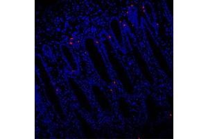Immunofluorescence (Paraffin-embedded Sections) (IF (p)) image for anti-Eukaryotic Translation Initiation Factor 2, Subunit 2 Beta, 38kDa (EIF2S2) antibody (ABIN7073880)