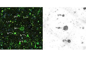 Immunohistochemical analysis of paraffin-embedded Alzheimer's hippocampus using Thioflavin S (left panel) and Beta Amyloid antibody using the HRP-DAB staining technique. (beta Amyloid Antikörper)