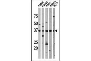 Western blot analysis of anti-Phospho-p53-T18 Pab (cat (ABIN389626 and ABIN2839626)) in, from left to right, , Ramos, mouse lung, mouse testis, and HL60 cell line lysates.