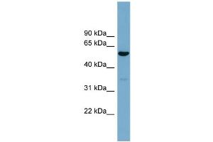 WB Suggested Anti-ACTR10  Antibody Titration: 0. (ACTR10 Antikörper  (Middle Region))