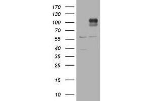 Western Blotting (WB) image for anti-ADAM Metallopeptidase with thrombospondin Type 1 Motif, 8 (ADAMTS8) antibody (ABIN2715722) (ADAMTS8 Antikörper)