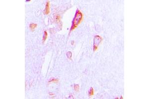 Immunohistochemical analysis of Cytochrome P450 1A1/2 staining in human brain formalin fixed paraffin embedded tissue section. (CYP1A1/2 Antikörper  (Center))