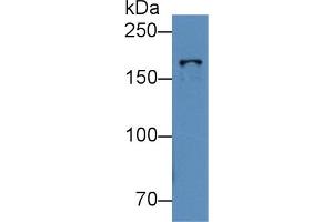 Western Blot; Sample: Human K562 cell lysate; Primary Ab: 2µg/mL Rabbit Anti-Mouse TOP2b Antibody Second Ab: 0. (TOP2B Antikörper  (AA 446-655))