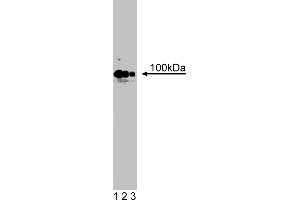 Western Blotting (WB) image for anti-Cadherin 4 (CDH4) (AA 22-201) antibody (ABIN967954) (Cadherin 4 Antikörper  (AA 22-201))