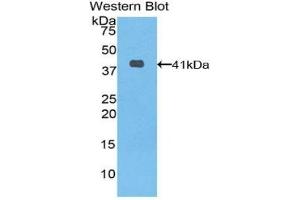 Detection of Recombinant KRT6A, Human using Polyclonal Antibody to Keratin 6A (KRT6A) (KRT6A Antikörper  (AA 163-468))