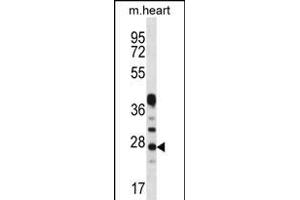 CRYBA1 Antibody (Center) (ABIN656311 and ABIN2845613) western blot analysis in mouse heart tissue lysates (35 μg/lane). (CRYBA1 Antikörper  (AA 104-133))