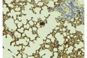 Immunohistochemistry (IHC) image for anti-Claudin 1 (CLDN1) (C-Term) antibody (ABIN6260877)