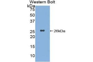 Western blot analysis of the recombinant protein. (XPC Antikörper  (AA 734-933))