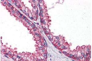 Human Prostate: Formalin-Fixed, Paraffin-Embedded (FFPE) (PTER Antikörper  (C-Term))