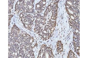 IHC analysis of Cyclophilin E/PPIE using anti-Cyclophilin E/PPIE antibody (ABIN7599242). (PPIE Antikörper  (AA 1-301))