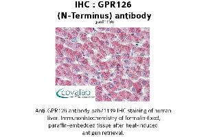 Image no. 1 for anti-G Protein-Coupled Receptor 126 (GPR126) (N-Term) antibody (ABIN1734925) (G Protein-Coupled Receptor 126 Antikörper  (N-Term))