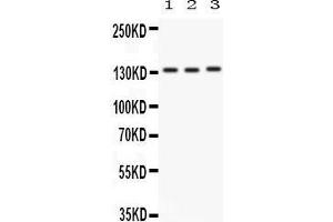Anti-Integrin alpha 1 antibody, Western blotting All lanes: Anti ITGA1 () at 0.
