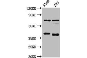 Western Blot Positive WB detected in: A549 whole cell lysate, 293 whole cell lysate All lanes: CTSS antibody at 1:4000 Secondary Goat polyclonal to rabbit IgG at 1/50000 dilution Predicted band size: 38, 32 kDa Observed band size: 38 kDa (Cathepsin S Antikörper  (AA 115-331))