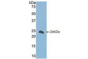 Detection of Recombinant FceRII, Mouse using Polyclonal Antibody to Cluster Of Differentiation 23 (CD23) (FCER2 Antikörper  (AA 150-330))