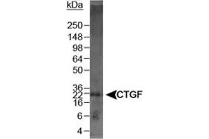 Western blot analysis of CTGF in mouse kidney lysate using CTGF polyclonal antibody . (CTGF Antikörper  (AA 299-349))