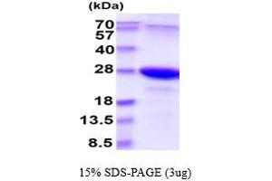 SDS-PAGE (SDS) image for Synaptosomal-Associated Protein, 23kDa (SNAP23) (AA 1-211) protein (ABIN667088)