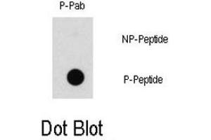 Dot blot analysis of RAF1 (phospho S43) polyclonal antibody  on nitrocellulose membrane. (RAF1 Antikörper  (pSer43))